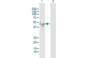 Western Blot analysis of KRT34 expression in transfected 293T cell line by KRT34 MaxPab polyclonal antibody. (Keratin 34 antibody  (AA 1-436))