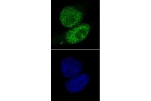 SMARCA4 antibody (mAb) (Clone 5B7) tested by immunofluorescence. (SMARCA4 antibody  (AA 213-295))