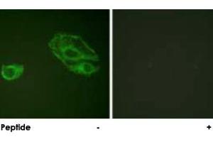 Immunofluorescence analysis of A-549 cells, using ERBB3 polyclonal antibody . (ERBB3 antibody)