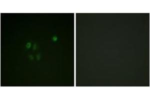 Immunofluorescence analysis of A549 cells, using Chk1 (Ab-301) Antibody.