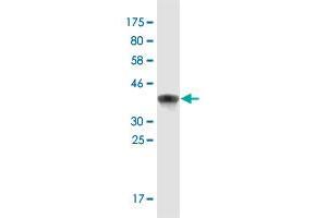 Western Blot detection against Immunogen (37. (NFAT5 antibody  (AA 1422-1531))