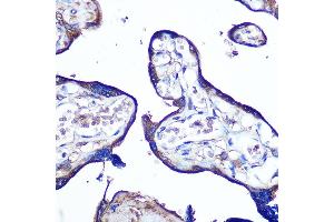 Immunohistochemistry of paraffin-embedded human placenta using JAM-A/CD321/F11R Rabbit pAb (ABIN3021822, ABIN3021823, ABIN3021824, ABIN1512881 and ABIN6216028) at dilution of 1:100 (40x lens). (F11R antibody  (AA 30-238))