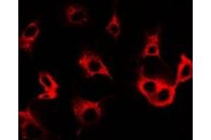 Immunofluorescent analysis of Cullin 5 staining in SW480 cells. (Cullin 5 antibody)