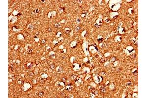 Immunohistochemistry of paraffin-embedded human brain tissue using ABIN7154668 at dilution of 1:100 (GNG11 antibody  (AA 1-70))