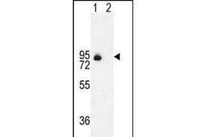 Western blot analysis of ENG (arrow) using rabbit polyclonal ENG Antibody (Center) (ABIN655186 and ABIN2844801). (Endoglin antibody  (AA 265-294))