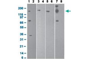 Western blot analysis with DNMT1 monoclonal antibody, clone 60B1220.