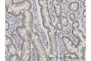 Immunoperoxidase of monoclonal antibody to FIS1 on formalin-fixed paraffin-embedded human small Intestine. (Fission 1 antibody  (AA 1-152))