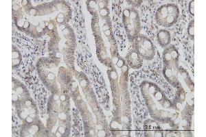 Immunoperoxidase of monoclonal antibody to FIS1 on formalin-fixed paraffin-embedded human small Intestine.