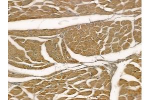 ABIN6257400 and ABIN6273967 at 1/100 staining human tongue carcinoma by IHC-P.