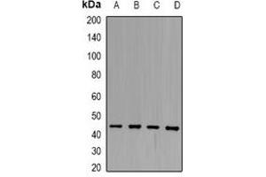 Western blot analysis of SCCA1 expression in Hela (A), HepG2 (B), HEK293T (C), SHSY5Y (D) whole cell lysates. (SERPINB3 antibody)