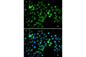 Immunofluorescence analysis of A549 cell using MTF2 antibody. (MTF2 antibody)