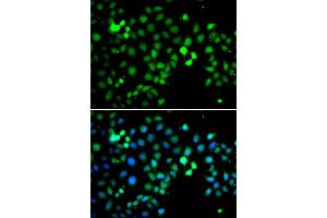 Immunofluorescence analysis of A549 cell using MTF2 antibody. (MTF2 antibody)