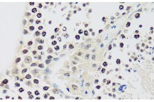Immunohistochemistry of paraffin-embedded Mouse testis using CCNE2 Polyclonal Antibody at dilution of 1:100 (40x lens).