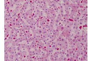 Human Liver: Formalin-Fixed, Paraffin-Embedded (FFPE) (CARD11 antibody)