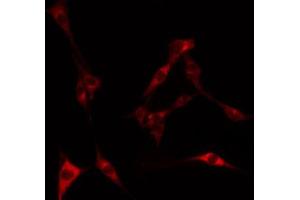 ABIN6269372 staining HeLa by IF/ICC. (LKB1 antibody  (Internal Region))