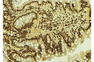ABIN6273604 at 1/100 staining Mouse colon tissue by IHC-P.