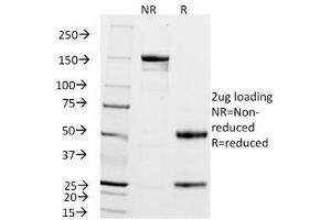 SDS-PAGE Analysis of Purified, BSA-Free ZAP-70 Antibody (clone 2F3.