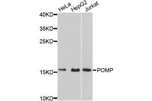 Western blot analysis of extracts of various cell lines, using POMP antibody (ABIN5996666) at 1:3000 dilution. (POMP antibody)