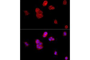 Immunofluorescence analysis of MCF7 cells using E-Cadherin Rabbit pAb  at dilution of 1:100 (40x lens).