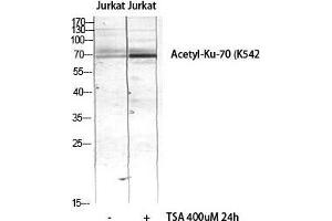 Western Blot (WB) analysis of JK lysis using Acetyl-Ku-70 (K542) antibody. (XRCC6 antibody  (acLys542))