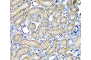 Immunohistochemistry of paraffin-embedded Rat kidney using PDCD6 Polyclonal Antibody at dilution of 1:200 (40x lens). (PDCD6 antibody)