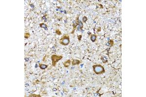 Immunohistochemistry of paraffin-embedded mouse spinal cord using MLC3A antibody (ABIN6134219, ABIN6143466, ABIN6143468 and ABIN6215215) at dilution of 1:100 (40x lens). (MAP1LC3A antibody  (AA 1-100))