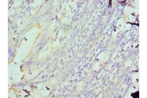 Immunohistochemistry of paraffin-embedded human colon using ABIN7160089 at dilution of 1:100 (MAD2L1 antibody  (AA 1-205))