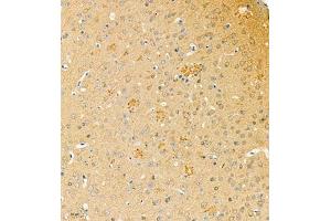 Immunohistochemistry of paraffin embedded mouse brain using phospho-TAU (S202/T205) (ABIN7075838) at dilution of 1: 1200 (tau antibody  (pSer202, pThr205))