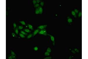 Immunofluorescent analysis of HepG2 cells using ABIN7149476 at dilution of 1:100 and Alexa Fluor 488-congugated AffiniPure Goat Anti-Rabbit IgG(H+L) (DACH1 antibody  (AA 166-369))