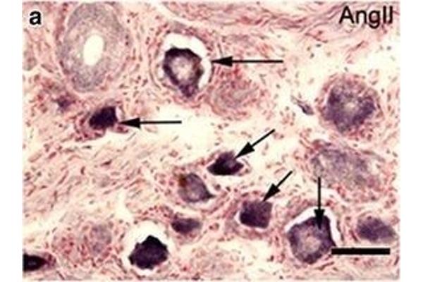 Angiotensin II antibody