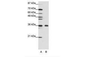 Image no. 2 for anti-Fibrillarin (FBL) (AA 61-110) antibody (ABIN307418) (Fibrillarin antibody  (AA 61-110))