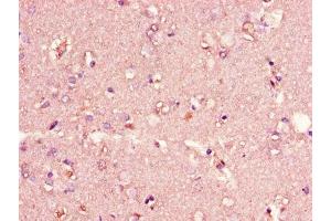 Immunohistochemistry of paraffin-embedded human brain tissue using ABIN7147273 at dilution of 1:100 (CIDEA antibody  (AA 1-51))