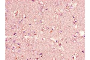 Immunohistochemistry of paraffin-embedded human brain tissue using ABIN7147273 at dilution of 1:100 (CIDEA antibody  (AA 1-51))