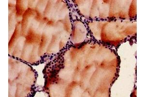 Immunohistochemistry of paraffin-embedded human thyroid tissue using ABIN7142951 at dilution of 1:100 (SLC33A1 antibody  (AA 1-74))