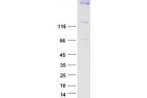 Validation with Western Blot (Synaptojanin 1 Protein (SYNJ1) (Transcript Variant 2) (Myc-DYKDDDDK Tag))
