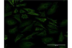 Immunofluorescence of monoclonal antibody to PKLR on HeLa cell.