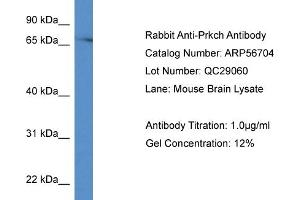 Western Blotting (WB) image for anti-Protein Kinase C, eta (PRKCH) (C-Term) antibody (ABIN785834) (PKC eta antibody  (C-Term))