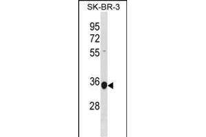 MRPL45 Antibody (C-term) (ABIN1881553 and ABIN2838917) western blot analysis in SK-BR-3 cell line lysates (35 μg/lane). (MRPL45 antibody  (C-Term))