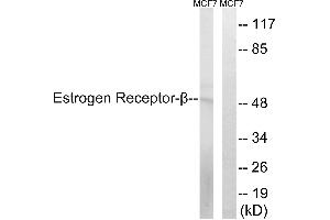 Western blot analysis of extracts from MCF-7 cells, using Estrogen Receptor-β (Ab-87) antibody. (ESR2 antibody  (Ser87))