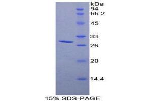 SDS-PAGE (SDS) image for DEAD (Asp-Glu-Ala-Asp) Box Polypeptide 58 (DDX58) (AA 1-211) protein (His tag) (ABIN2126666)