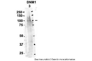 Sample Type: 3. (Dynamin 1 antibody  (Middle Region))