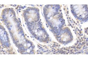 Detection of BMP2 in Bovine Colon Tissue using Polyclonal Antibody to Bone Morphogenetic Protein 2 (BMP2) (BMP2 antibody  (AA 24-395))