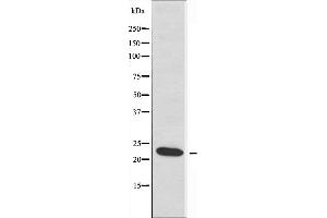 Western blot analysis of extracts from HeLa cells, using RPL17 antibody.
