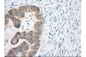 Immunohistochemical staining of paraffin-embedded Human Kidney tissue using anti-EIF2S1 mouse monoclonal antibody. (EIF2S1 antibody)