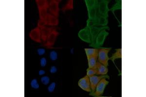 anti-RhoA,B,C antibody