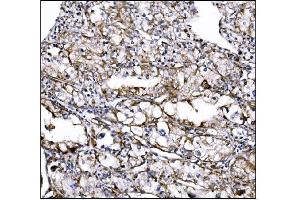 IHC analysis of DLGAP1 using anti-DLGAP1 antibody (ABIN7600257). (DLGAP1 antibody  (AA 17-319))