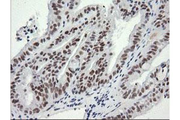 SESTD1 antibody