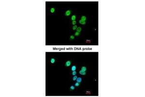 ICC/IF Image Immunofluorescence analysis of paraformaldehyde-fixed A549, using RASAL1, antibody at 1:200 dilution. (RASAL1 antibody  (C-Term))