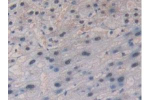 Detection of GR in Human Liver Tissue using Polyclonal Antibody to Glutathione Reductase (GR) (Glutathione Reductase antibody  (AA 44-522))