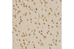 Immunohistochemistry of paraffin-embedded mouse brain using BMI1 antibody at dilution of 1:200 (x400 lens).